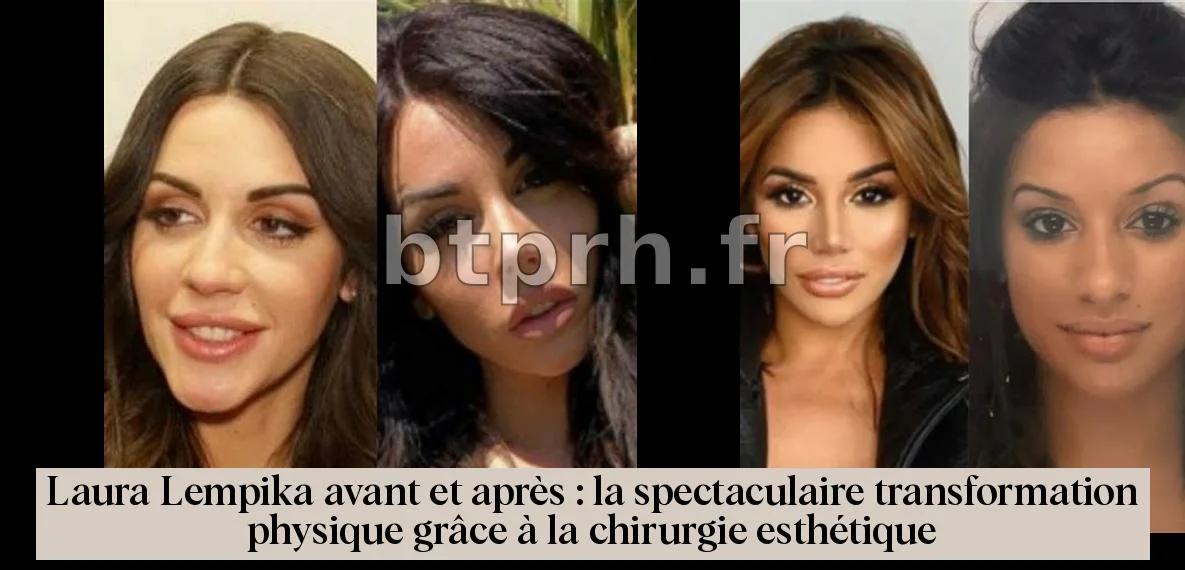 Laura Lempika Avant : Une Exploration de sa Transformation Physique et de sa Vie