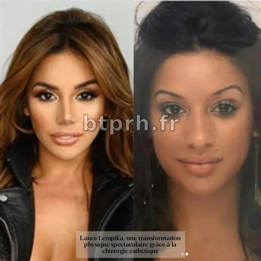 Laura Lempika avant et après : la spectaculaire transformation physique ...