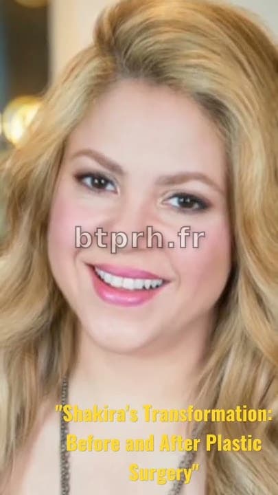 Shakira's Transformation: Before and After Plastic Surgery - YouTube