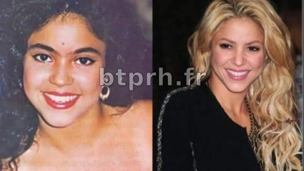 La Chirurgie Esthétique de Shakira : Un Voyage à Travers sa Transformation