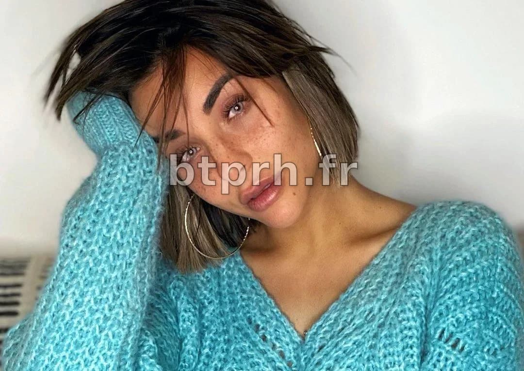 Rym Renom Chirurgie : Révélations sur la Chirurgie de Rym Renom - Avant ...